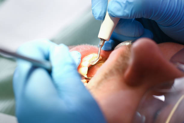 Best Weekend Emergency Dentist in Kendallville, IN